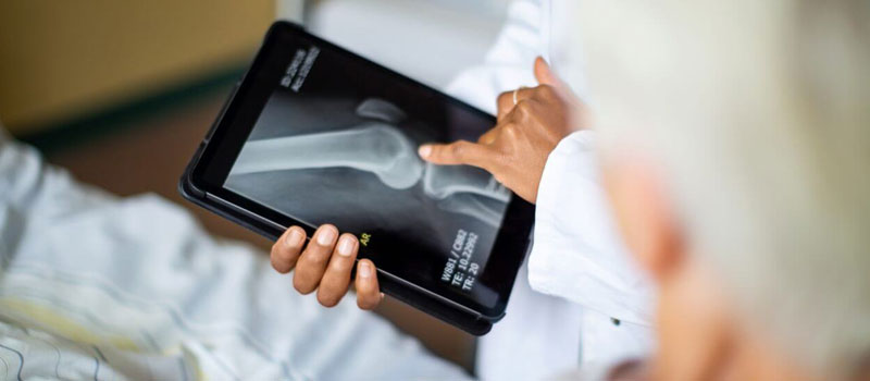 Abdomen X-Ray at Home in Mumbai