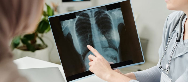 Chest X-Ray Home Service in Mumbai