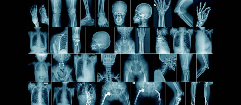 Complete Body X-Ray at Home in Mumbai