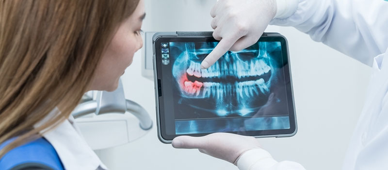 Dental X-Ray at Home in Mumbai