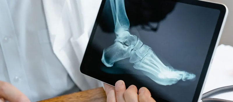Foot and Ankle X-Ray at Home in Mumbai