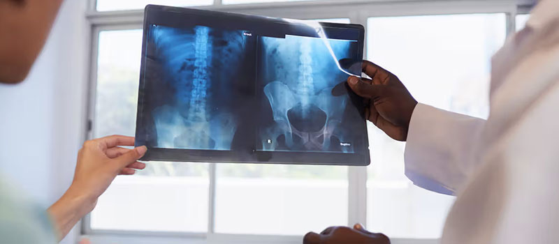 Hip Body X-Ray at Home in Mumbai