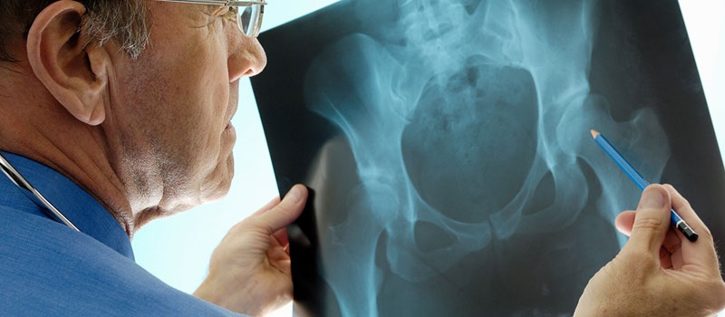 Orthopedic X-Ray at Home in Mumbai
