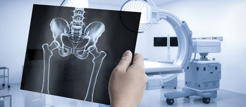 Rapid X-Ray at Home in Mumbai