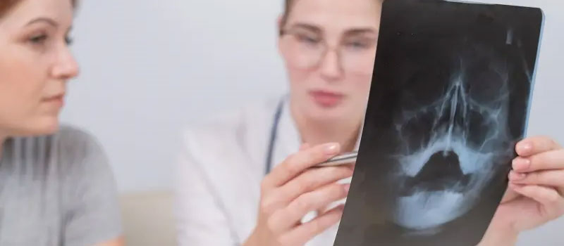 Reliable Sinus X-Ray at Home in Mumbai